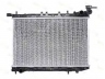 THERMOTEC D71004TT radiatorius, variklio aušinimas 
 Aušinimo sistema -> Radiatorius/alyvos aušintuvas -> Radiatorius/dalys
21410-62C01, 2141062C01