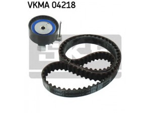 SKF VKMA 04218 paskirstymo diržo komplektas 
 Techninės priežiūros dalys -> Papildomas remontas
1361983, 1376164, 1675963, 5M5G 6K254 AB