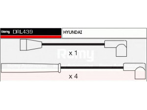 DELCO REMY DRL439 uždegimo laido komplektas 
 Kibirkšties / kaitinamasis uždegimas -> Uždegimo laidai/jungtys
27501-22A00, 27501-24B10