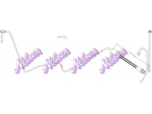 Brovex-Nelson H7116 stabdžių žarnelė 
 Stabdžių sistema -> Stabdžių žarnelės
1379913, 1380832, 1403401, 1426764