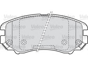 VALEO 598744 stabdžių trinkelių rinkinys, diskinis stabdys 
 Techninės priežiūros dalys -> Papildomas remontas
58101-2CA20, 58101-2EA11, 58101-2HA10