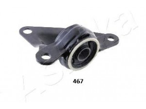 ASHIKA GOM-467 laikiklis, valdymo svirties montavimas 
 Ašies montavimas/vairavimo mechanizmas/ratai -> Valdymo svirtis/pasukamosios svirties sujungimas -> Montavimas/sutvirtinimas