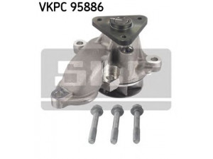 SKF VKPC 95886 vandens siurblys 
 Aušinimo sistema -> Vandens siurblys/tarpiklis -> Vandens siurblys
11403-08506K, 25100-2A200, 25100-2A201